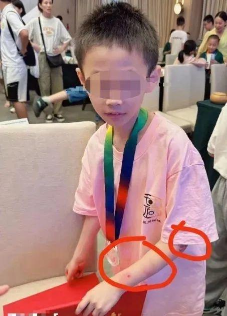 9岁围棋少年意外坠亡父亲发声回应家暴质疑：从来没有打伤过他 来听新闻(图5)